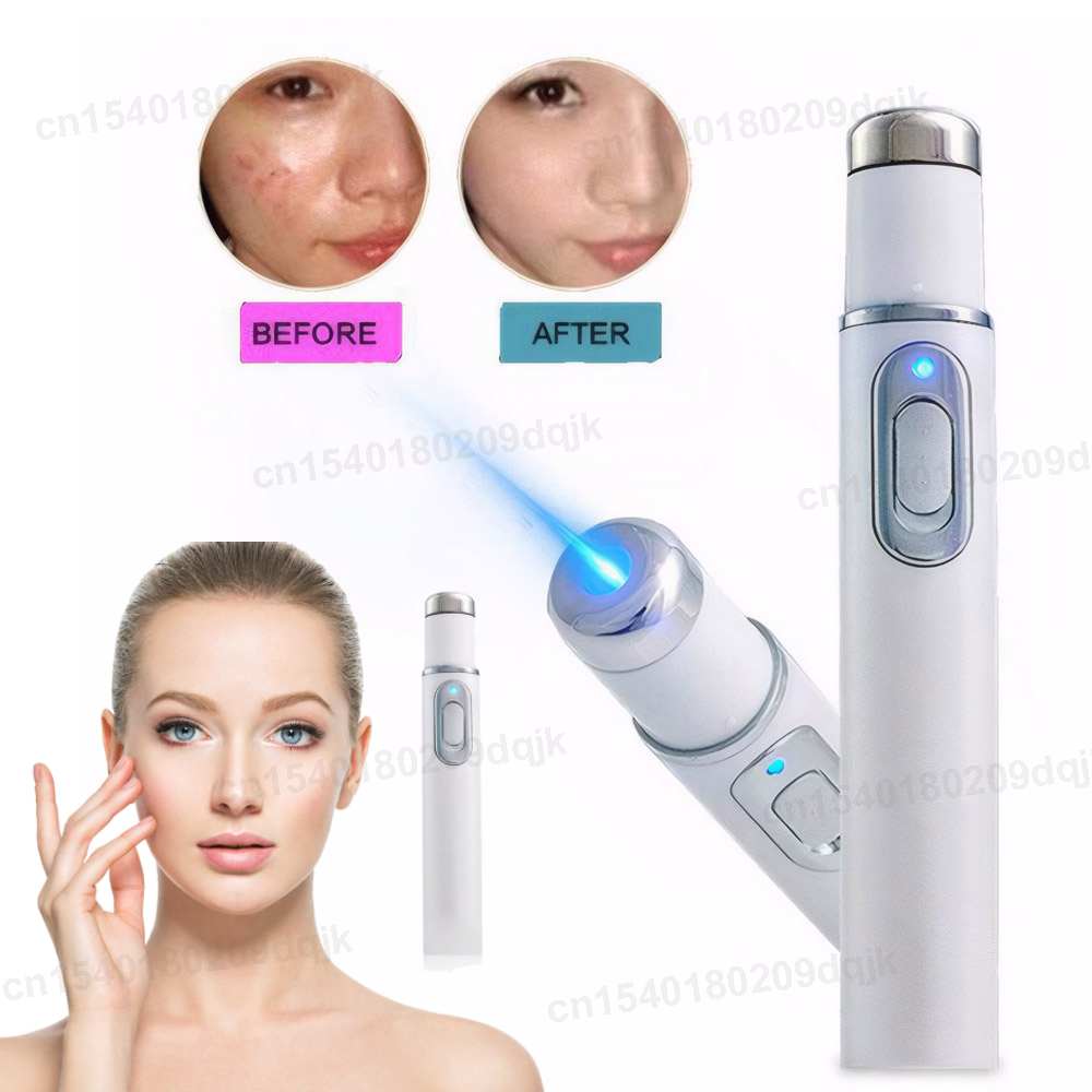 Acne Light Therapy Pen - Pióro do terapii niebieskim światłem na